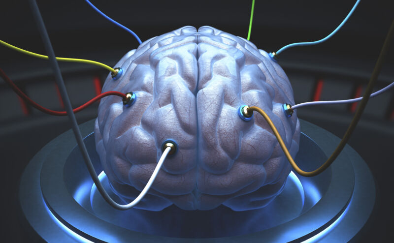 Image of a brain with wires attached.