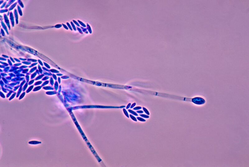 Image of stalks of a fungus on a purple-brown background.