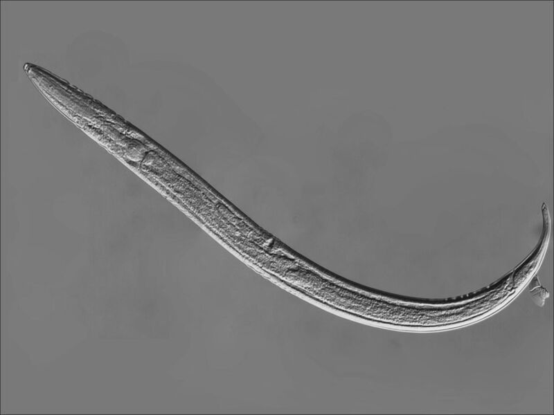 greyscale microscope image of a long, thin, unsegmented worm.