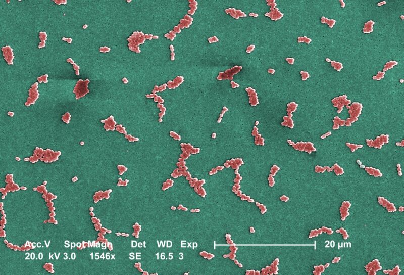 This Scanning Electron Microscope image depicts several clusters of aerobic Gram-negative, non-motile <i>Acinetobacter baumannii</i> bacteria under a magnification of 24,730x.Members of the genus <i>Acinetobacter</i> are nonmotile rods, 1-1.5µm in diameter, and 1.5-2.5µm in length, becoming spherical in shape while in their stationary phase of growth. This bacteria is oxidase-negative and therefore does not utilize oxygen for energy production. They also occur in pairs under magnification. <i>Acinetobacter spp.</i> are widely distributed in nature, and are normal flora on the skin.  Some members of the genus are important because they are an emerging cause of hospital acquired pulmonary, i.e., pneumoniae, hemopathic, and wound infections. Because the organism has developed substantial antimicrobial resistance, treatment of infections attributed to A. baumannii has become increasingly difficult.  The only drug that works on multi-resistant strains of A.baumannii is colistin which is a very toxic drug.
