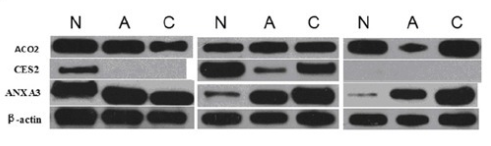 A western blot like this, with lots of individual images removed from their original context, makes it easy to commit research fraud.