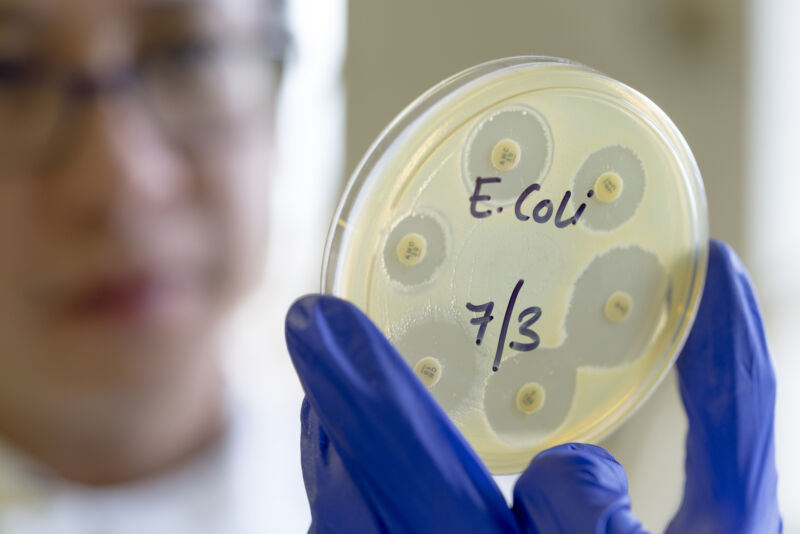 Woman holding a plate of bacteria with clusters of bacteria on it.