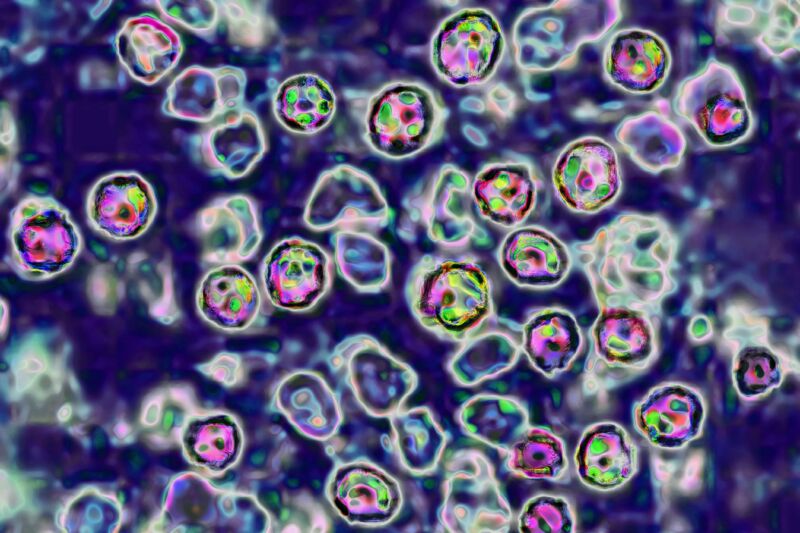 A Brightly colored transmission microscope image of measles viruses. 