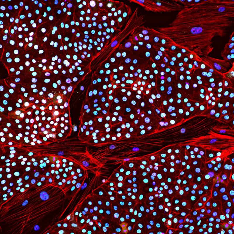 Large collection of cells with a red outline and white nucleus.