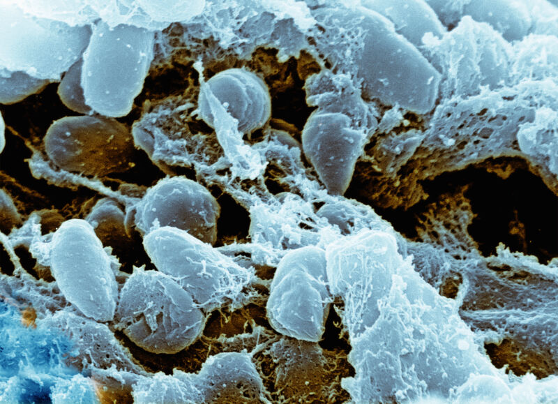 Colorized scanning electron microscope, SEM, image of Yersinia pestis bacteria