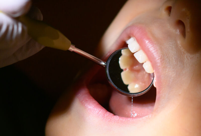 Do you need a dentist visit every 6 months? That filling? The data is weak