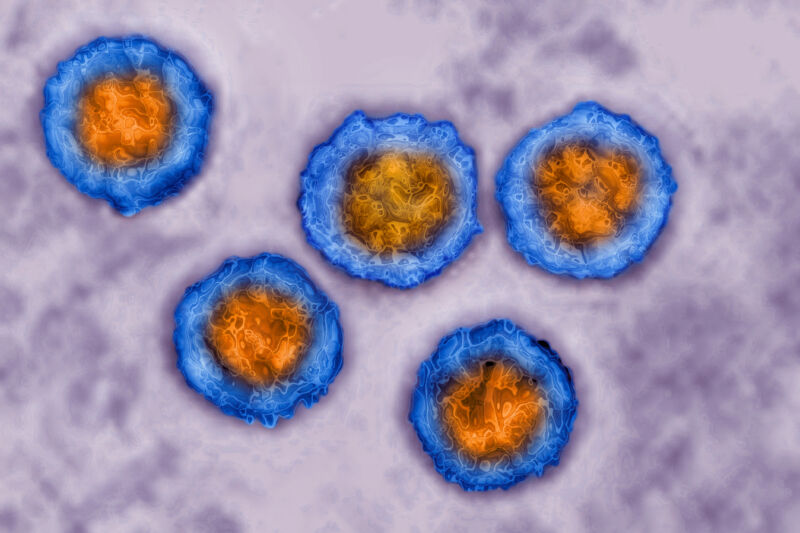 Herpes simplex virus, (HSV). Image taken with transmission electron microscopy.