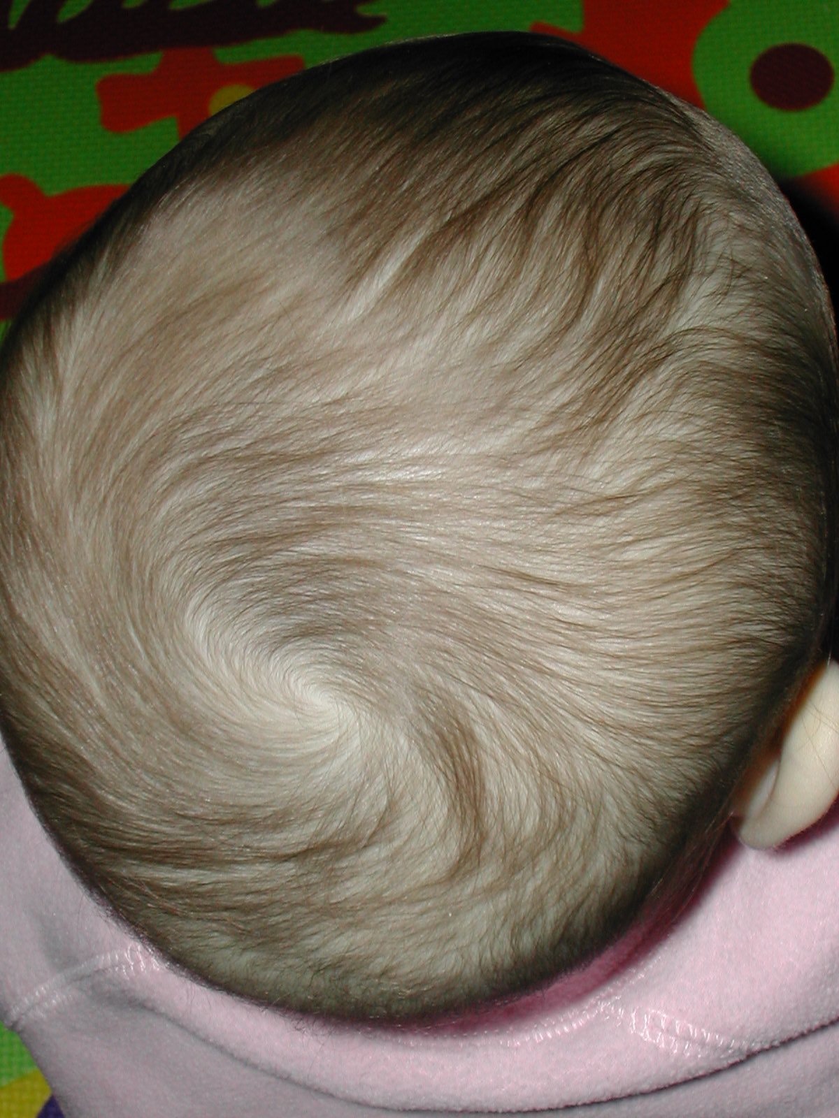 Hair whorl on the head of a one-year-old girl