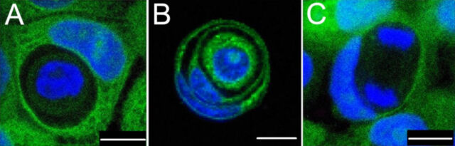 During entosis, one cell inserts itself within another. In these images, blue indicates cellular DNA and green indicates the cytoplasm, a cell’s gelatinous interior. One cell may exist within another cell (A); a cell may exist within a cell within yet another cell (B); and an inner cell may undergo DNA division (C).