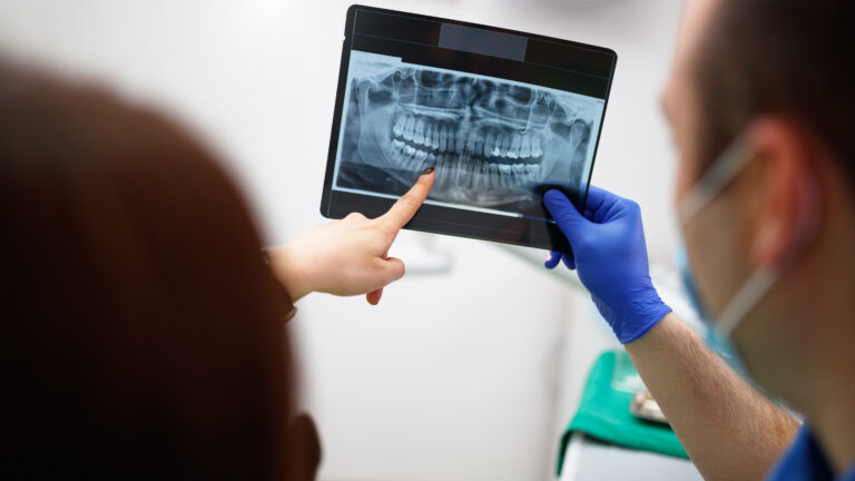 Listing image for first story in Most Read: Routine dental X-rays are not backed by evidence—experts want it to stop