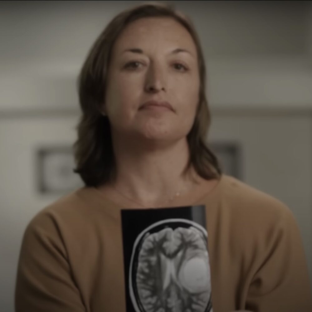 A woman holding an MRI displaying a brain tumor.