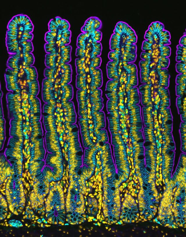 Section of the small intestine of a mouse