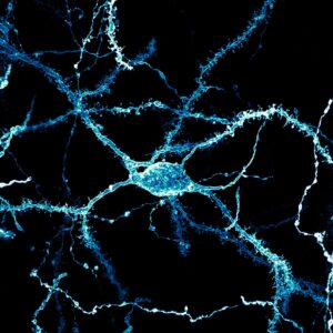 Een neuron dat dicht bedekt is met dendritische stekels uit het striatum van de hersenen van een volwassen muis