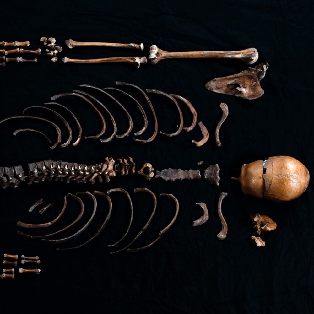 The Well-man skeleton, bones laid out in anatomical order