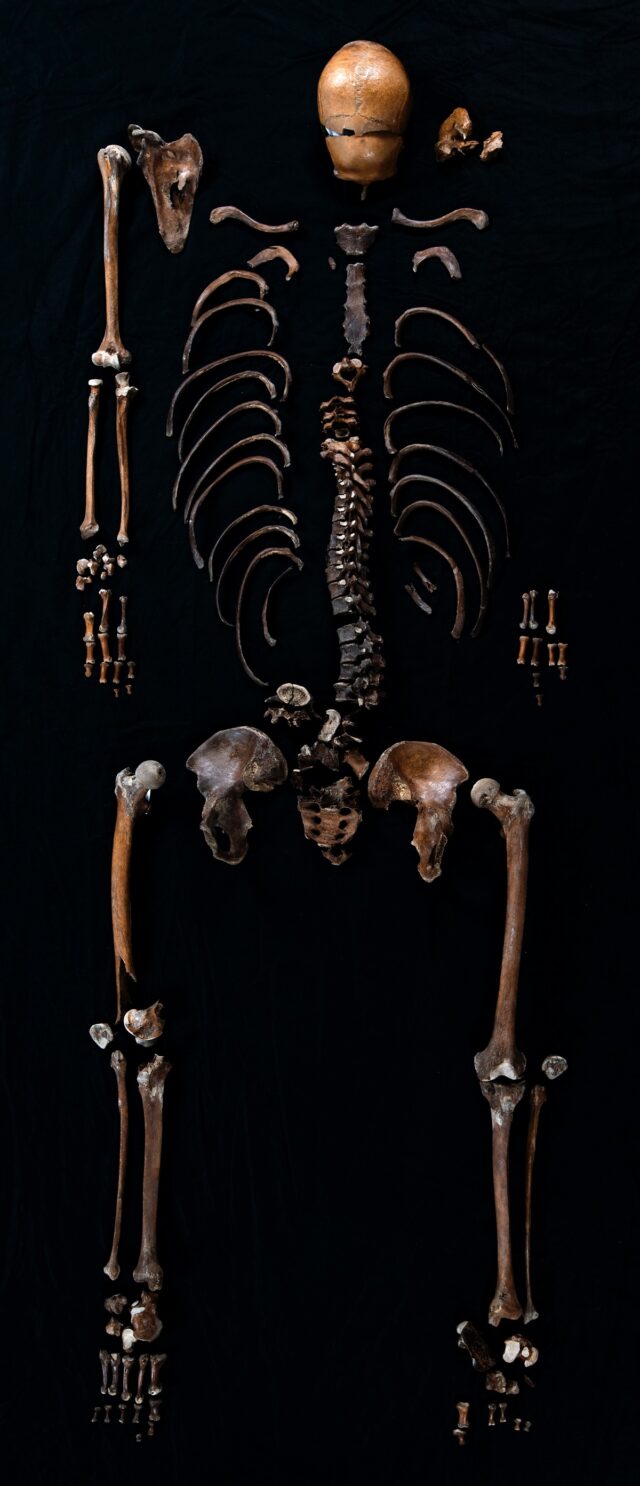 The fully assembled Well-man skeleton