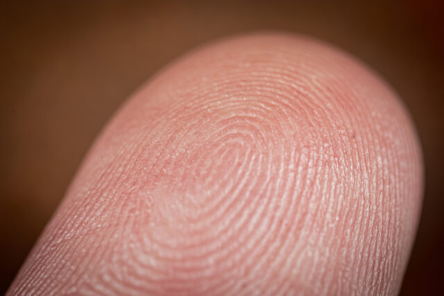 Photo of a finger.