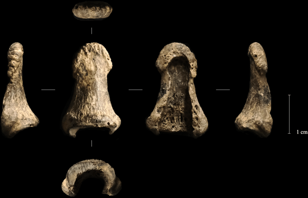 images of a human phalanx from several sides