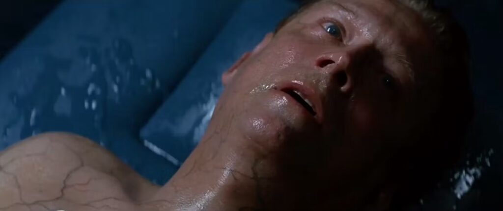 same man lying on hospital bench with water leaking from his skin