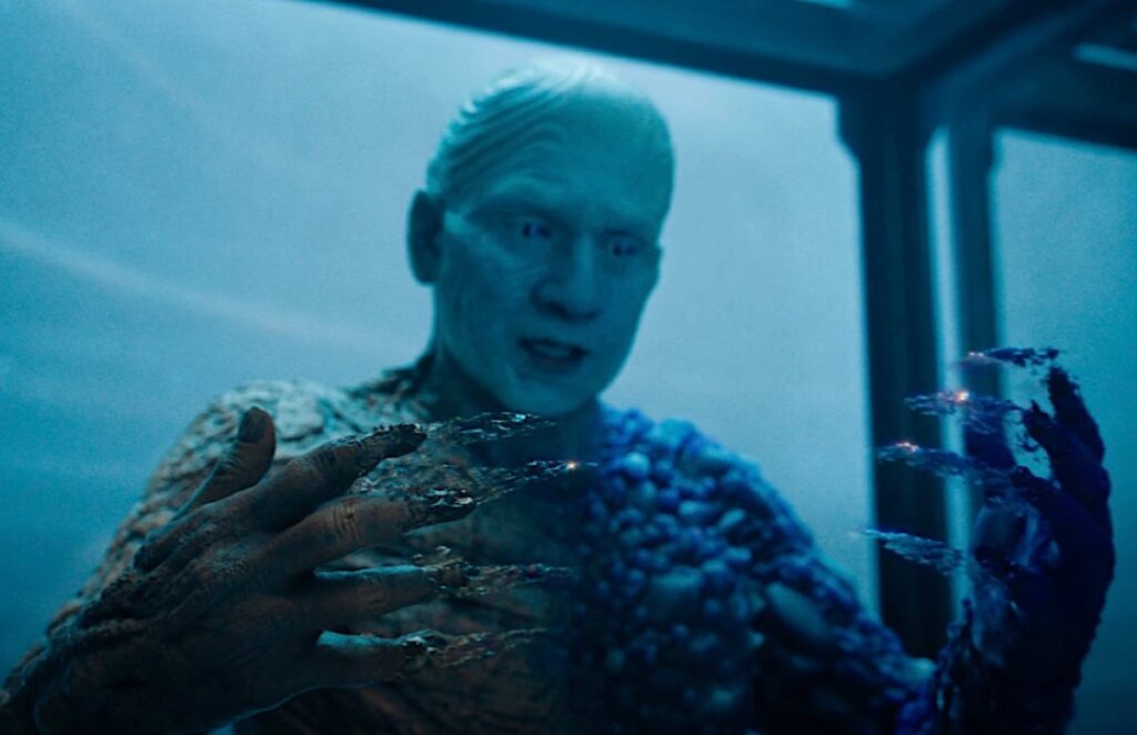 bald man with misshapen body and hands