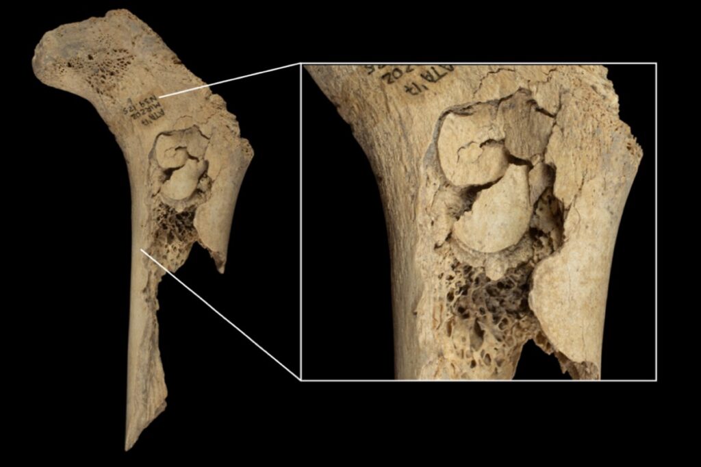 Infant human femur found at El Mirador, with percussion marks for marrow extraction.