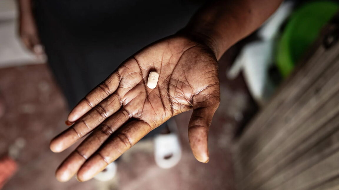 Five children see HIV viral loads vanish after taking antiretroviral drugs