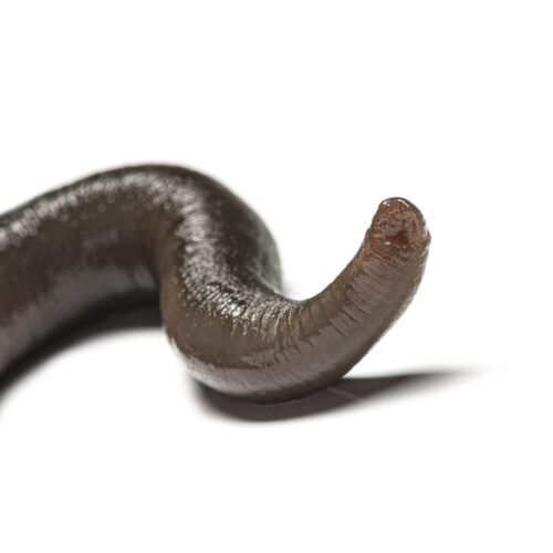 Man accidentally gets leech up his nose. It took 20 days to figure it out.