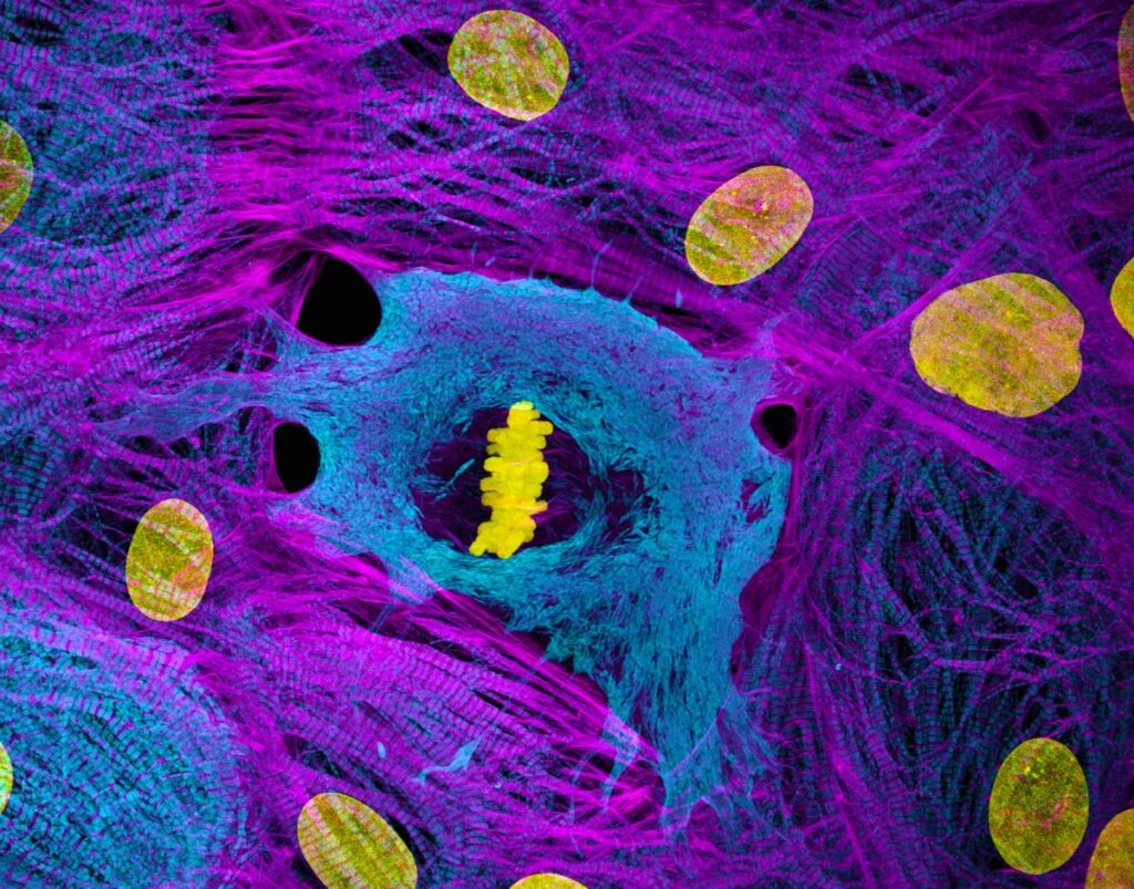 Heart muscle cells (iPSC-derived) showing condensed chromosomes in metaphase