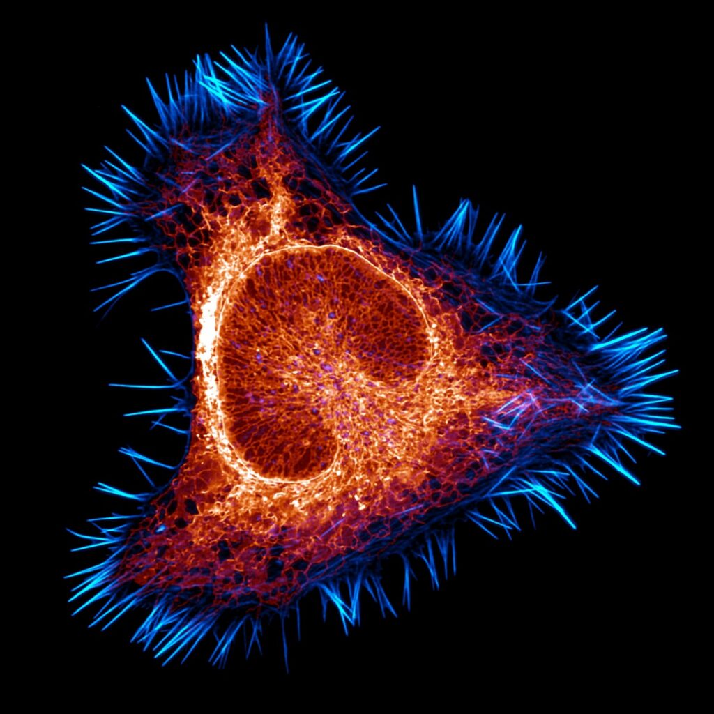 The actin cytoskeleton (cyan) and endoplasmic reticulum (red) of a mouse brain cancer cell