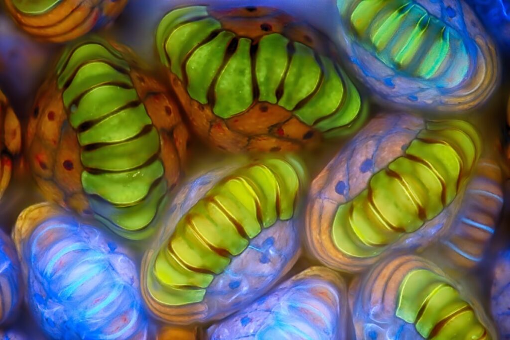 Spore sacs (sporangia) of a fern