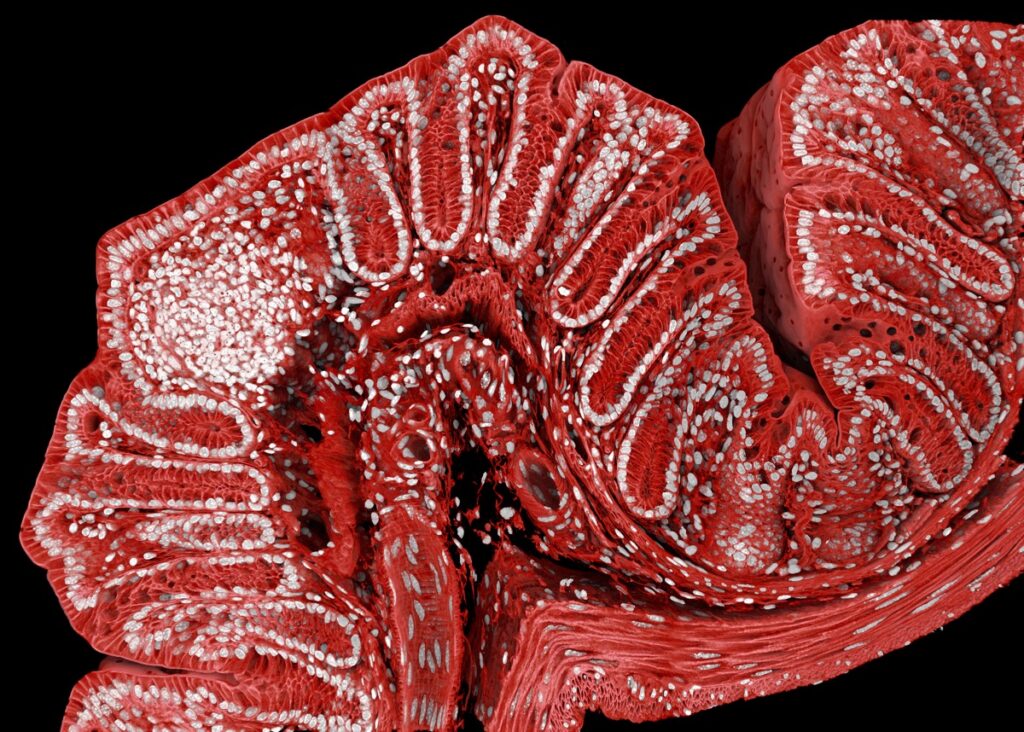 Fluorescently marked mouse colon