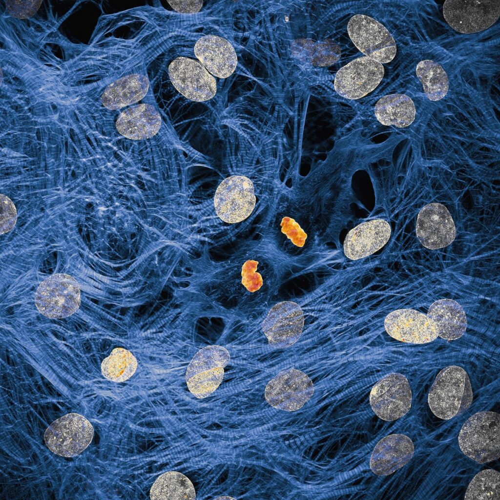 Heart muscle cells with chromosomes condensed following cell division