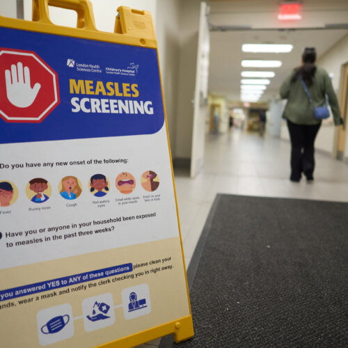 Canada fought measles and measles won; virus now endemic after 1998 elimination
