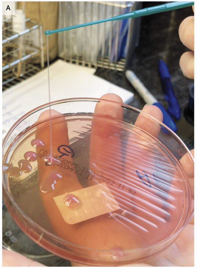 This may be the grossest eye pic ever—but the cause is what’s truly horrifying