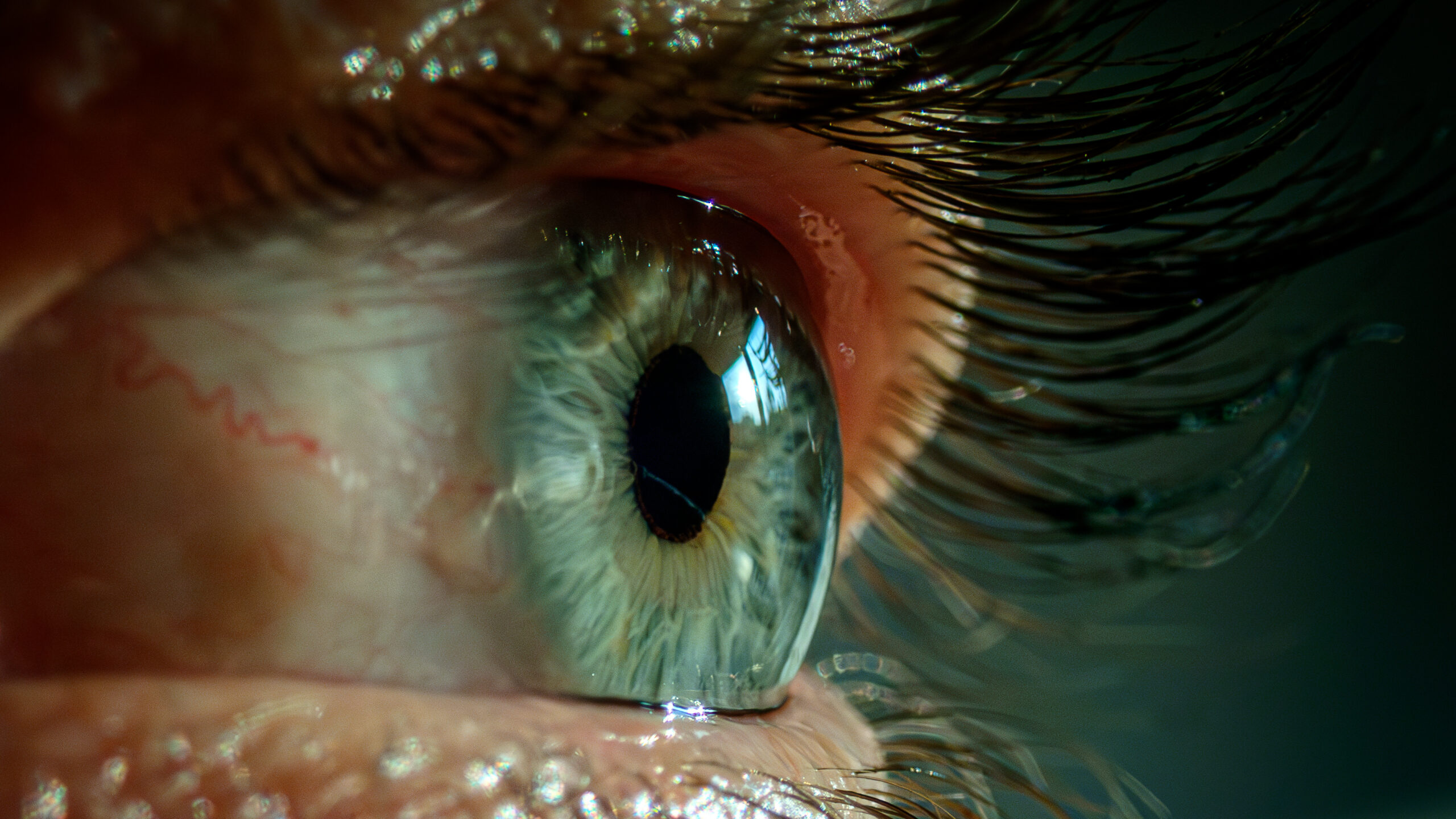 Bad sleep made woman's eyelids so floppy they flipped inside&hellip;