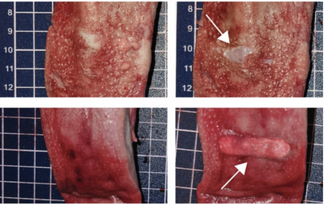 Example of tongue tissue damage after detachment
