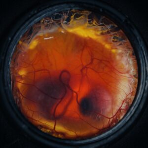 a chicken embryo, with visible eyes and beak, surrounded by blood vessels and inside a black metal container.
