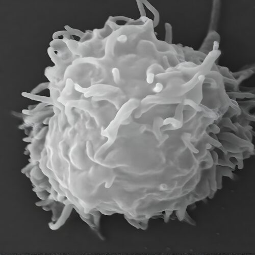 Man dies covered in necrotic lesions after amoebas eat him alive