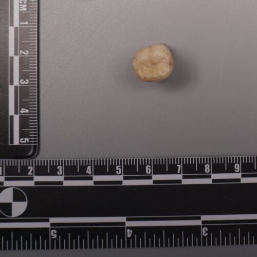 Protein in Homo erectus teeth suggests Denisovans gave us some of their DNA