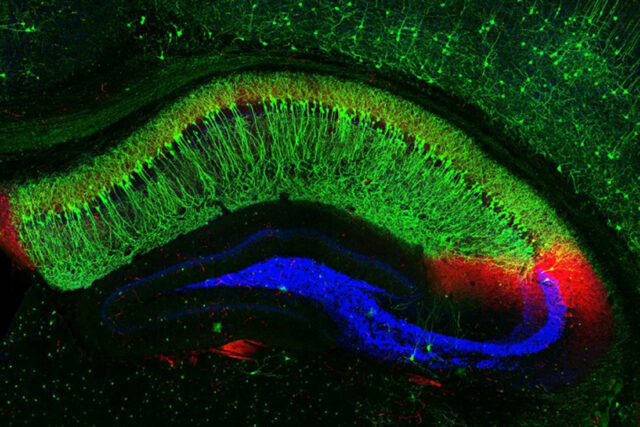 Cross section shows band of cells in the mouse hippocampus.