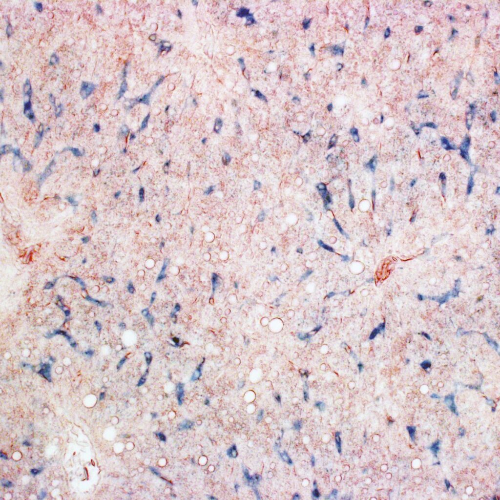 Histology of pigeon liver tissue, depicting iron-containing macrophages (blue).