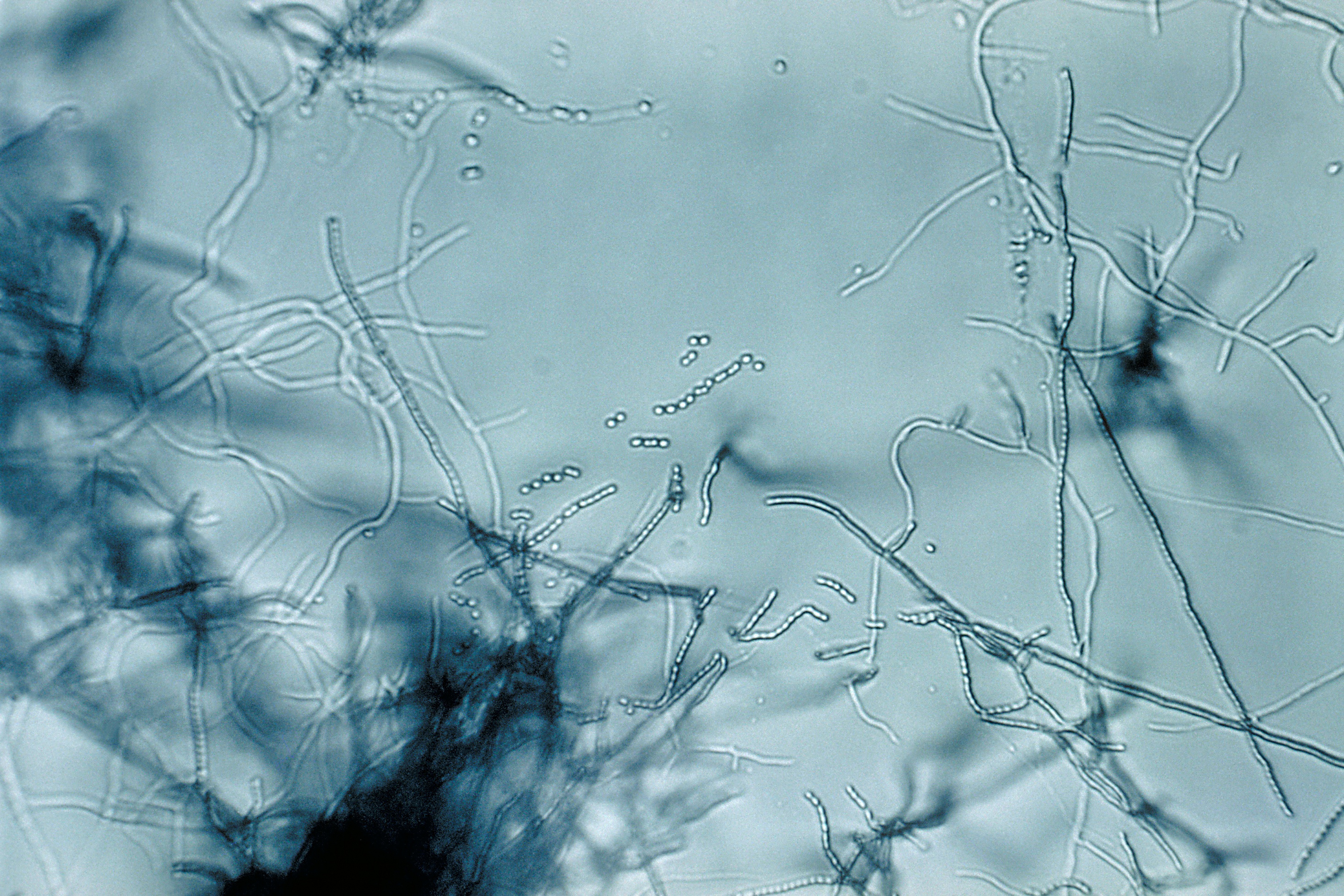 Antibiotic "megacluster" discovery provides new strategy to fight superbugs