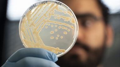 photo of a petri dish of yeast, held in front of a man's face in the background