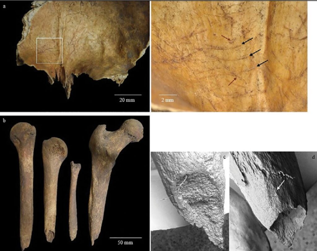 Evidence of intentional postmortem manipulation in an Iron Age female Briton