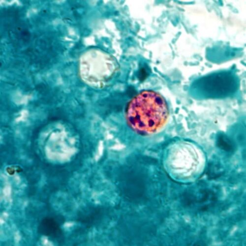 Michigan sees explosive outbreak of diarrheal parasite with over 700 cases