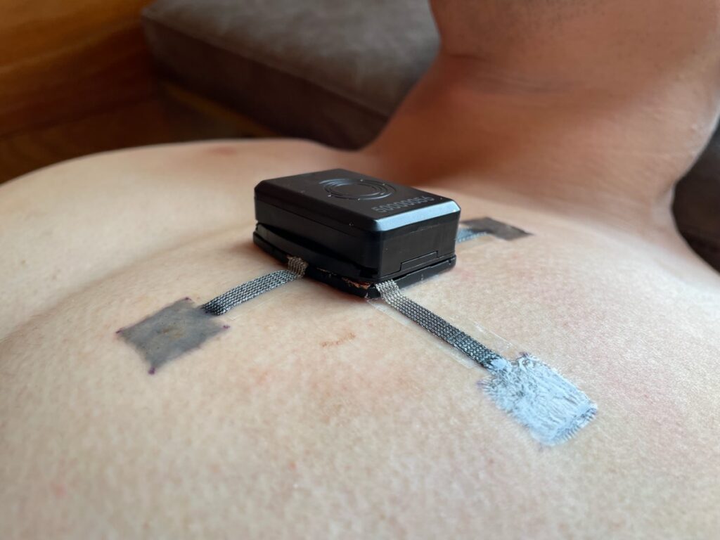 A WE-PPD electrode taped to a man's chest