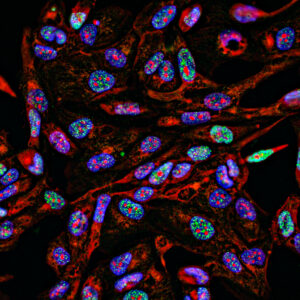 Lab supply companies have been selling antibodies using manipulated images