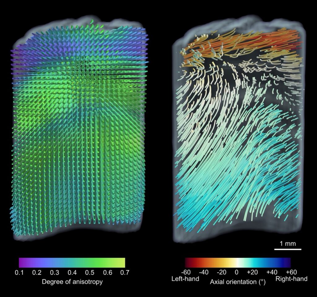 This 3D image shows how the mineralized collagen fibrils – the microscopic building blocks that give the tooth its strength – are arranged. It reveals their direction and how strongly they are aligned.