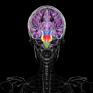 Image of a diagram of a human skull and upper torso in black and white. Segments of the brain are highlighted in color, with most of the color being a shade of pink that includes the entire top 2/3 of the brain.
