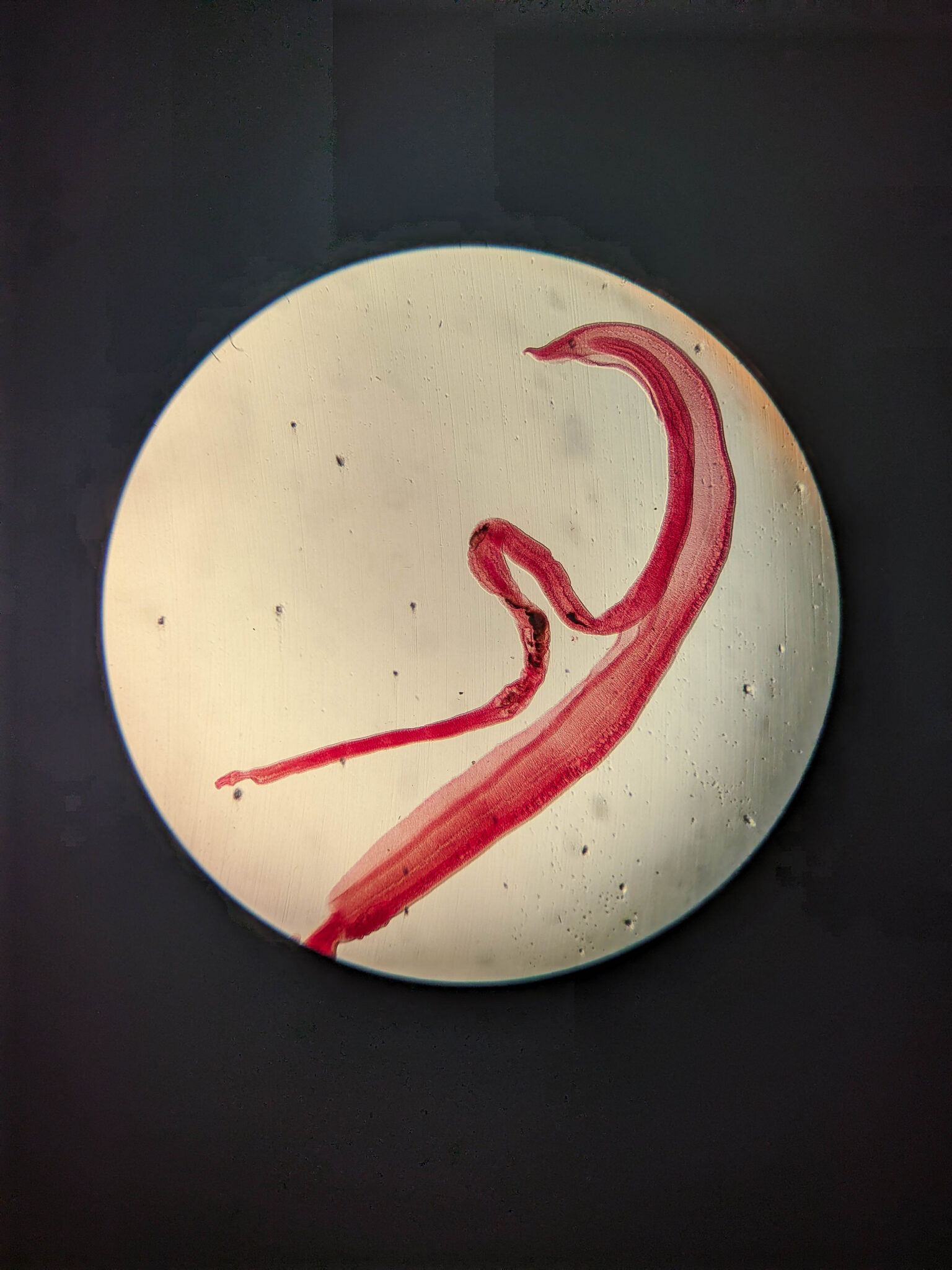 Fifty-year-old test confirms diagnosis