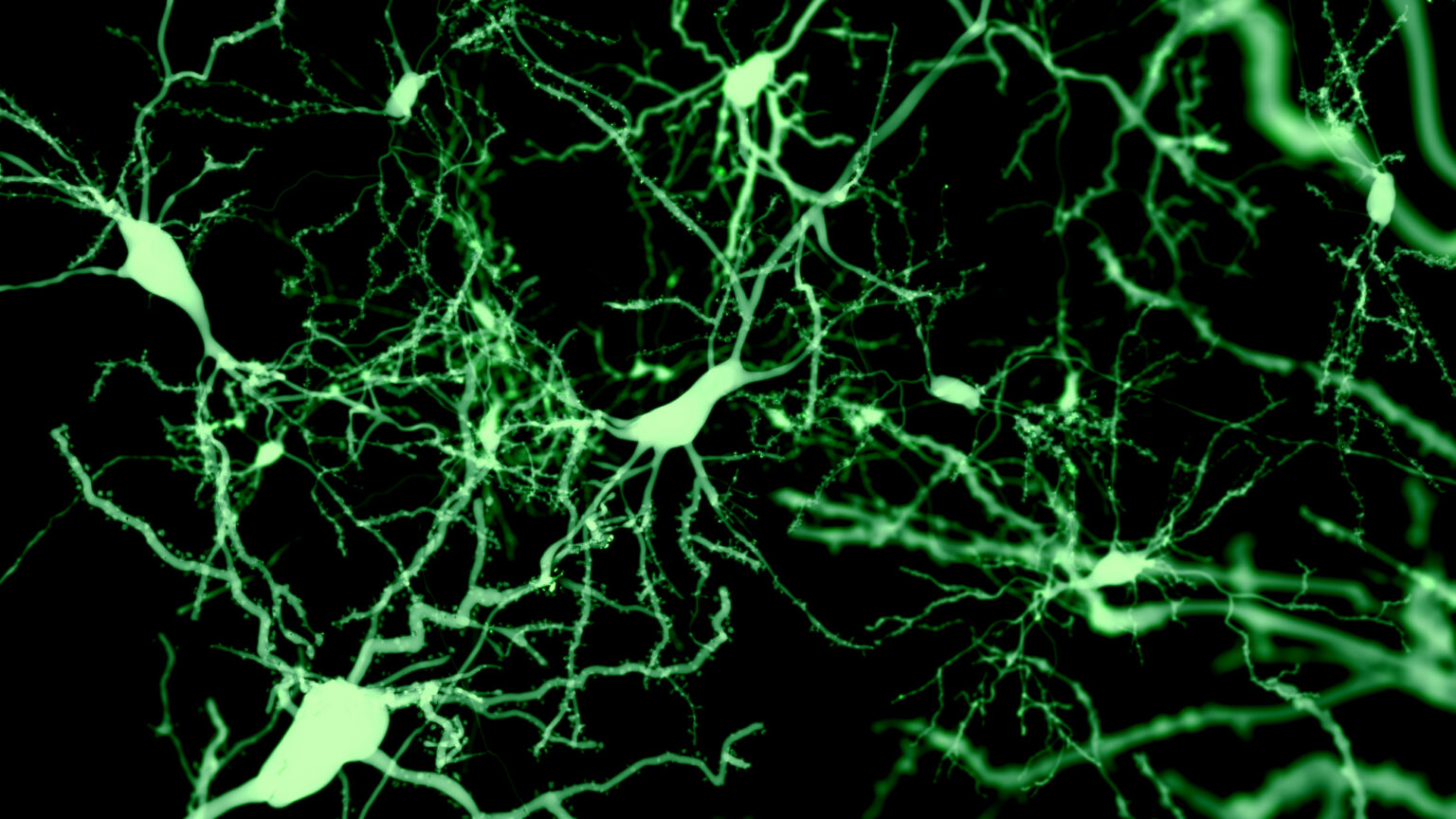 Black background with green fluorescent nerve cells.